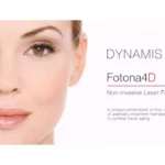 Fotona SP Dynamis and Fotona 4D: A Revolution in Non-Surgical Facial Rejuvenation