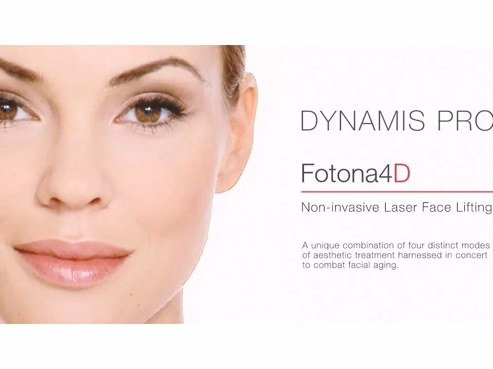Fotona SP Dynamis and Fotona 4D: A Revolution in Non-Surgical Facial Rejuvenation